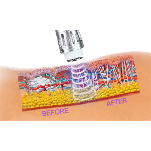 Soulagement de la douleur électrique de traitement d'Ed de machine d'onde de choc de la physiothérapie 50mj tenu dans la main