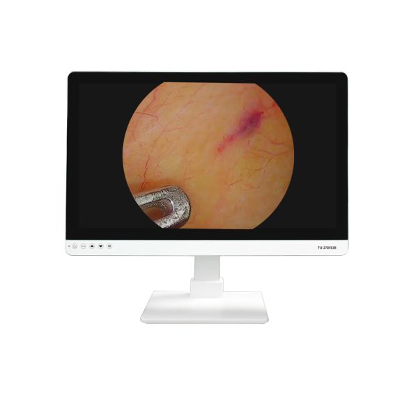 Equipo médico FHD 22 24 27 pulgadas Endoscopio Monitor de cámara Display Monitor médico Full HD