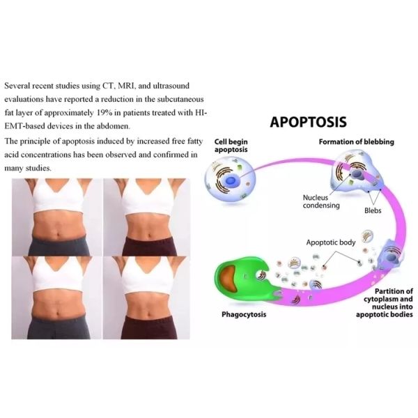 Spa EMS Fitness Muscle Stimulator Machine HI EMT 4 Handles White Color