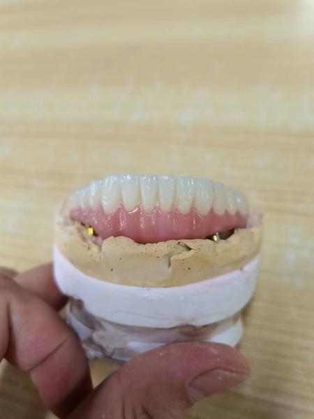 Consistência em cada coroa nosso processo de manufatura da coroa do implante dental