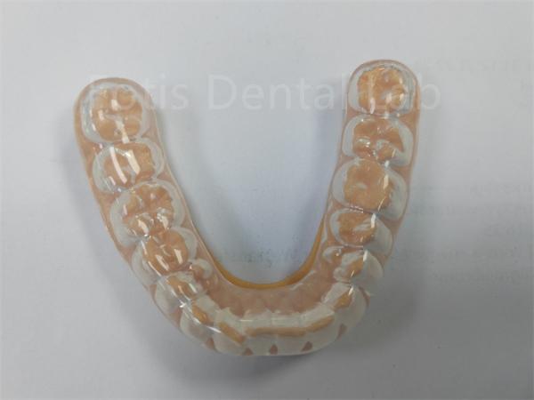 Professional Hard Soft Night Guard Keep Your Teeth Healthy Teeth Protection