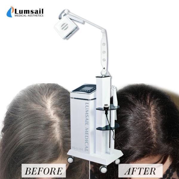 Máquina Handheld do laser do diodo da queda de cabelo da ponta de prova 650nm