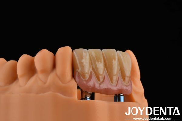 4.5mm Height Finished Abutments Internal Hex Connection Type Compatible With Implant Systems