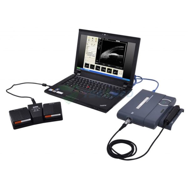 MD-320W ophthalmic Portable Ultrasound Biomicroscope medical equipment solutions