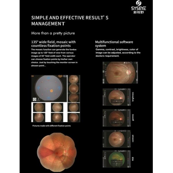 Automated Fundus Camera Clear Fundus Image Automated Focus 24 Megapixel mydriatic Anterior Photography Red-free optional FFA