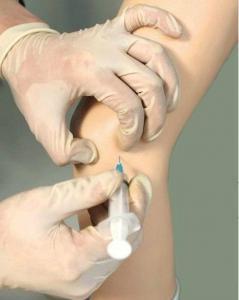 Injection Medical Sodium Hyaluronate Gel For Lubrication 1.0ml 2.0ml Prefilled Syringe