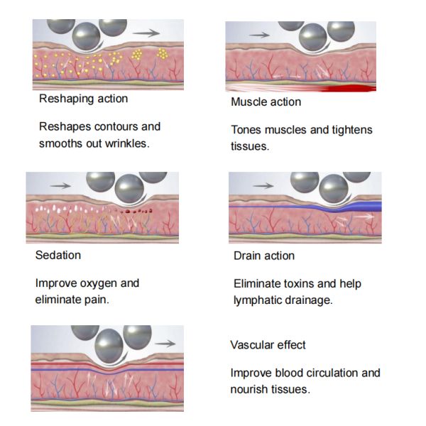 Luxmaster Vacuum Lipo Máquina de adelgazamiento láser para la escultura del cuerpo células grasas de destino con 532nm luz verde y terapia de rodillos