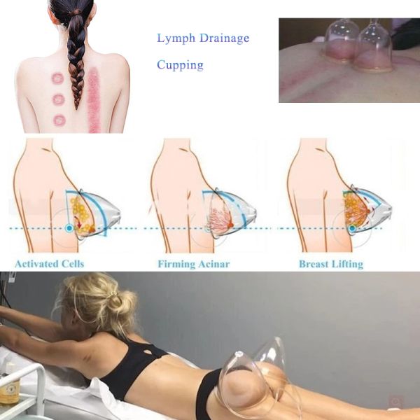 Cupping Vacuum Therapy Machine Butt Lifting Breast Enlargement Buttocks Enlarger With Large Cups