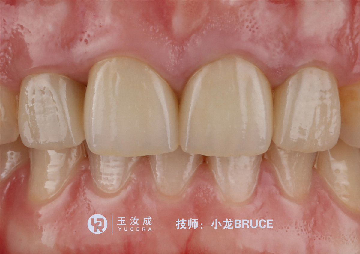 Yucera 3D плюс разнослоистый керамический блок 43% до 57% Zirconia просвечивающее для системы CAD CAM