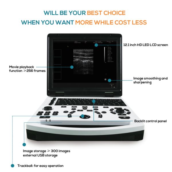 Digital Human Veterinary Portable Ultrasound Machine Ultrasound Portable Ultrasound