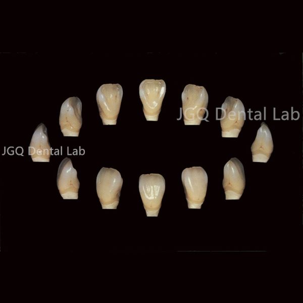 Natural Translucent Zirconia Restorations Custom Designed For Anterior Teeth