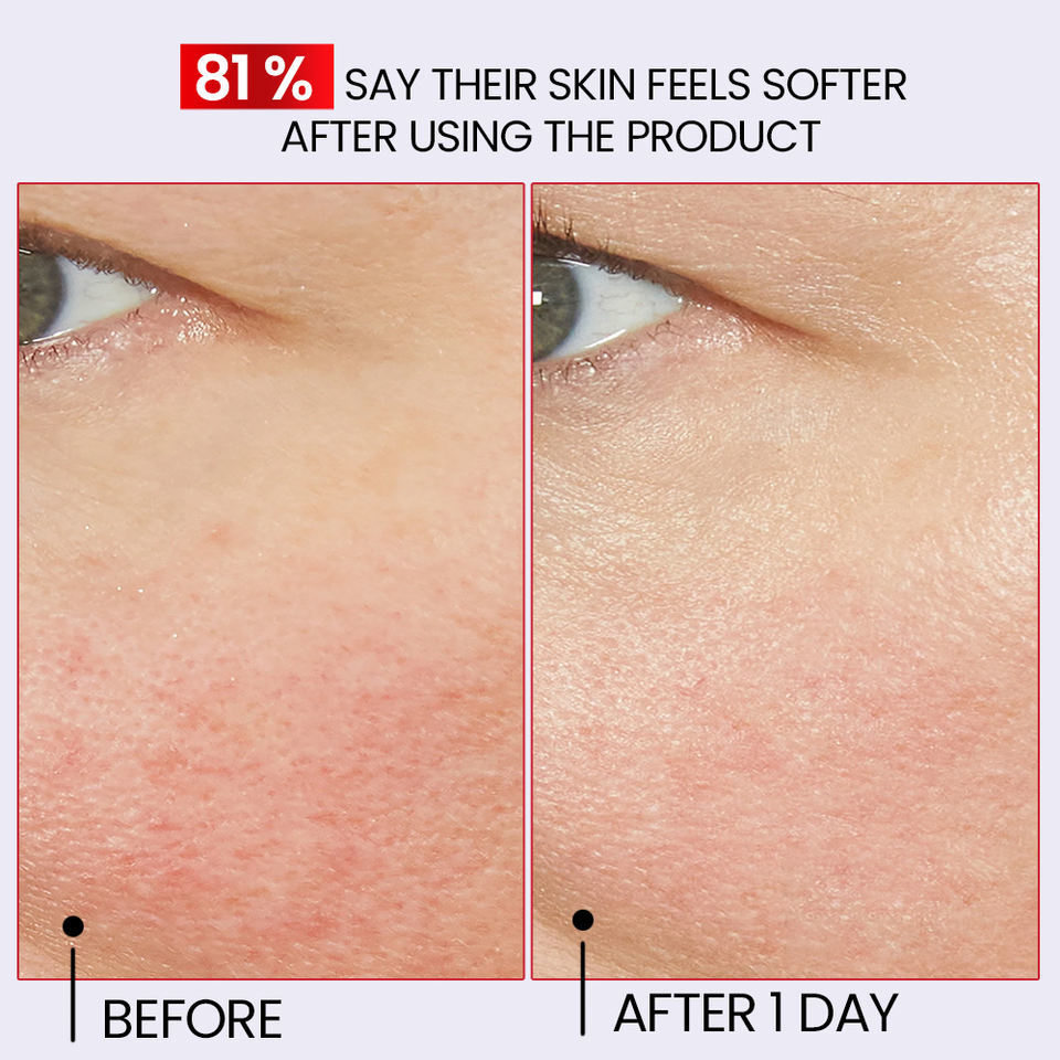 OEM ODM brand luxury soothing repair serum natural organic skin care reduce redness repair damaged skin facial serum essence