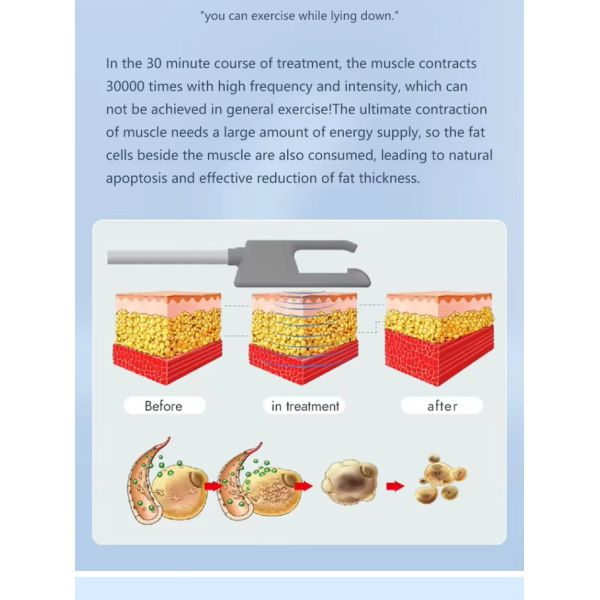 Новая модернизация Electro Magnetic body Slim NEO RF HIEMT Body Contouring Peach Hip EMS скульптурная машина