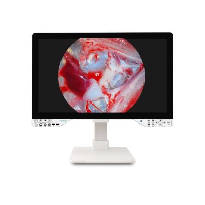 27 Medical Full HD Endoscope Camera For Gynecology Surgical With Light Source And Monitor