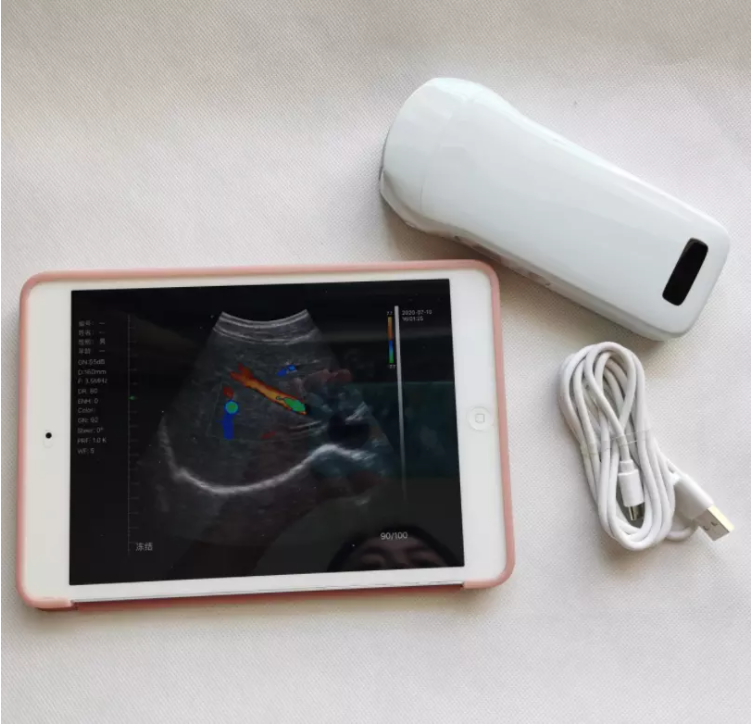 GYN Ultrasound Instruments Wireless Portable Clinical Probe Analytical Instruments Mobile Ultrasound Machine