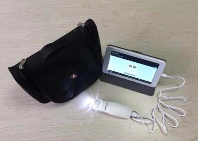 Colposcope eletrônico de Digitas do sinal do sistema avoirdupois da cor do AMIGO com cartão e monitor do TF