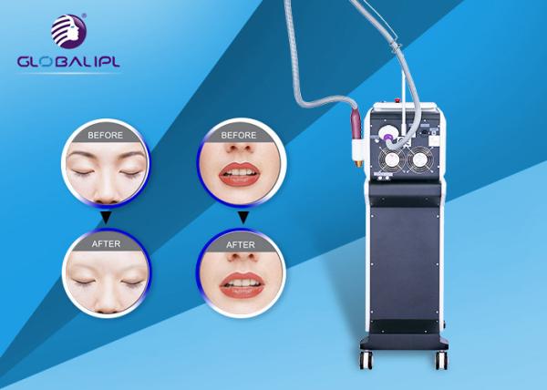 Pigment Melasma Removal Portable Laser Tattoo Removal Machine 1064 755 532nm Wavelength