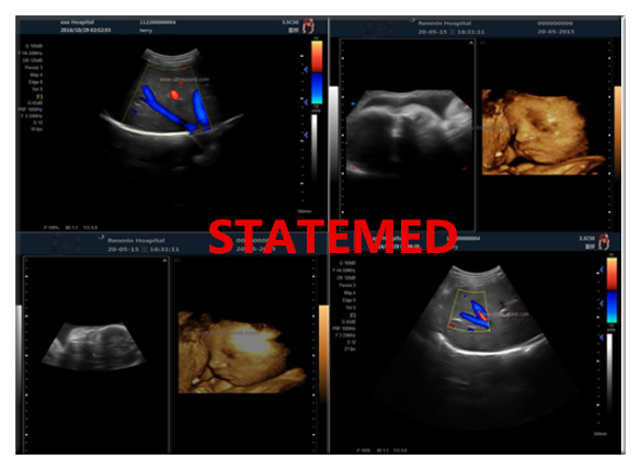 128 E 6.5 Kg Clinic Portable Ultrasound Scanner For Baby Scan 38×36.9×7.9 CM