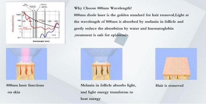 Stable Working 808 Laser Hair Removal Device , Skin Hair Removal Machine Painless