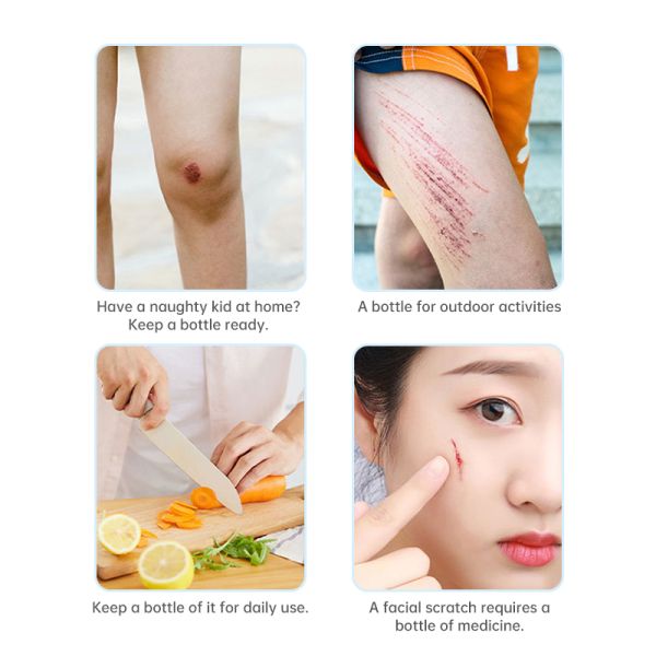 Washable Wound Care Spray 20ml Sterile Wound Dressing Spray For Abrasions Or Cuts