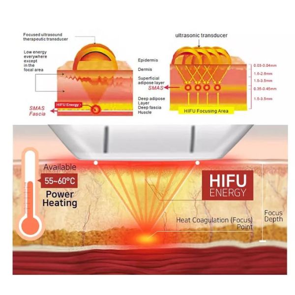 Линии 8 затягивать GOMECY 12 кожи машины подниматься стороны патронов 4D Hifu