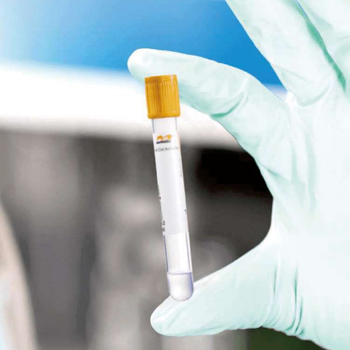 Free Sample Sterile Vacuum Blood Collection Tube