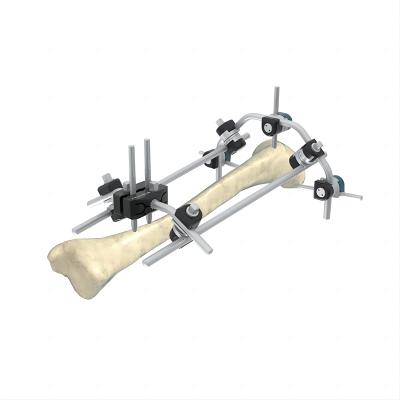 Humerus Tibia Monolateral External Fixator Q Type Combined External Fixation Device