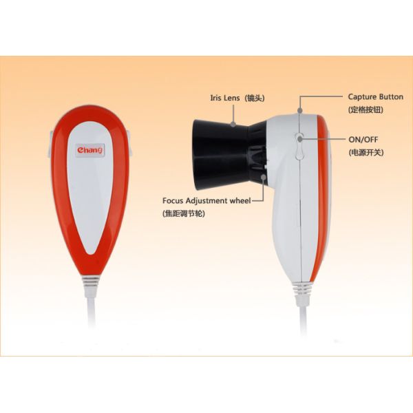 Cámara portátil de Iriscope Iridology
