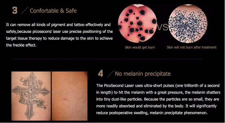 Профессиональная многофункциональная машина удаления шрама угорь татуировки лазера ПикоСуре 755нм