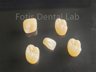 Aesthetic Appeal Full Porcelain Layered Zirconia Ideal For Crowns Bridges