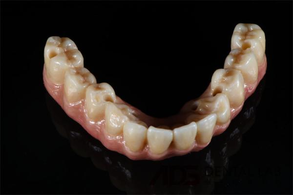 OEM Cylindrical Titanium Full Bridge Dental Implants All On 4 6