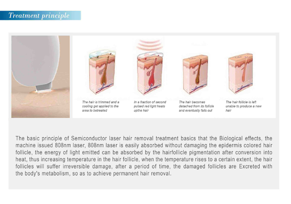 Approved CE 808nm diode laser  painless permanent 808nm laser hair removal machine