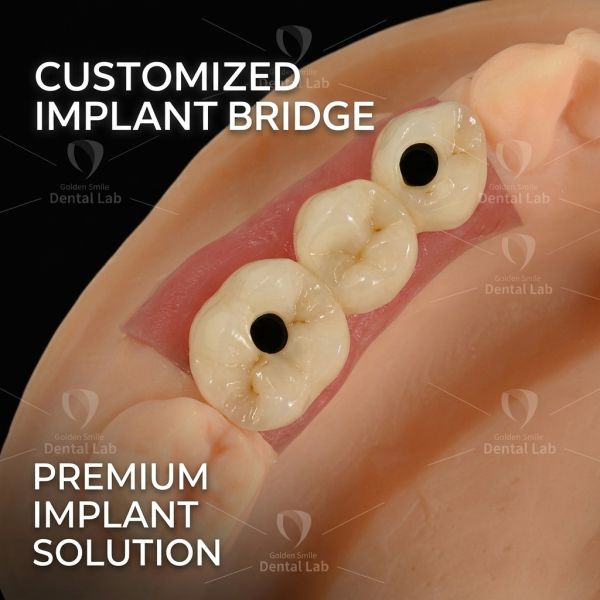 Customizable Digital Dental Lab Services Dental Crown And Bridge Design