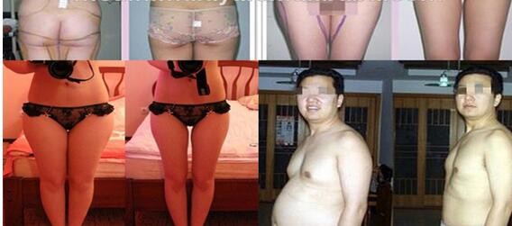 Fat reduction body shaping cryolipolysis slimming machine for women