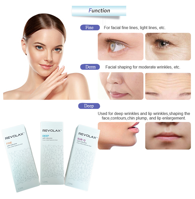 Перекрестный соединенный заполнитель Revolax Hyaluronic кисловочный для удаления морщинки