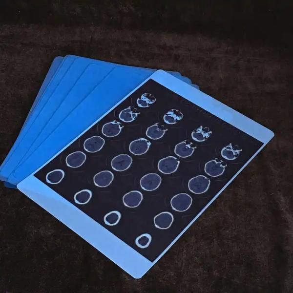 Advanced Blue Medical X Ray Film For Clear And Accurate Imaging