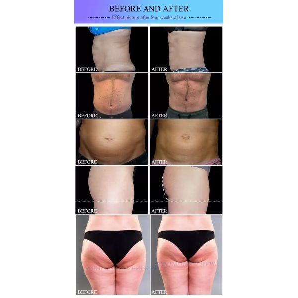 Venus Legacy Weight Loss Machine RF Vacuum Roller Massage Slimming Machine