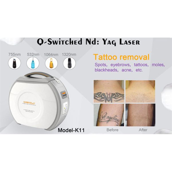 Переносный Q Switch Nd Yag Laser Machine Удаление пигмента
