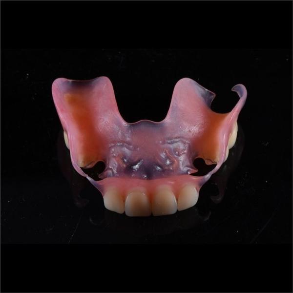 Comfortable Partial Valplast Flexible Dentures Nylon Material