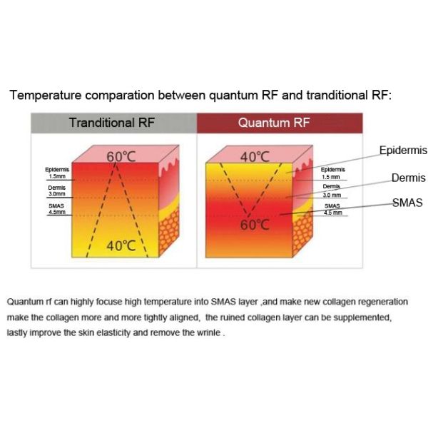 Оборудование красоты удаления 110в 220в РФ морщинки подниматься стороны