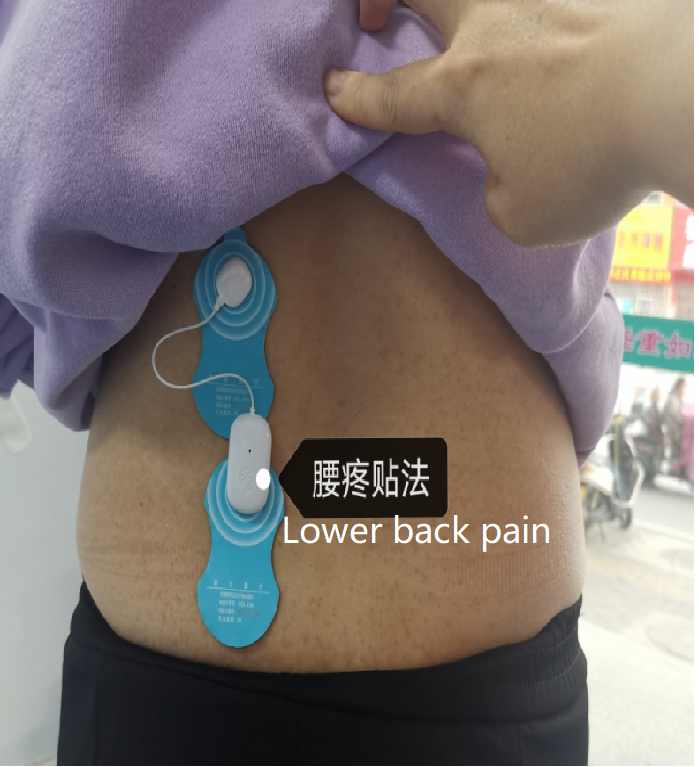 Низкочастотный mic-электрический настоящий столб терапией