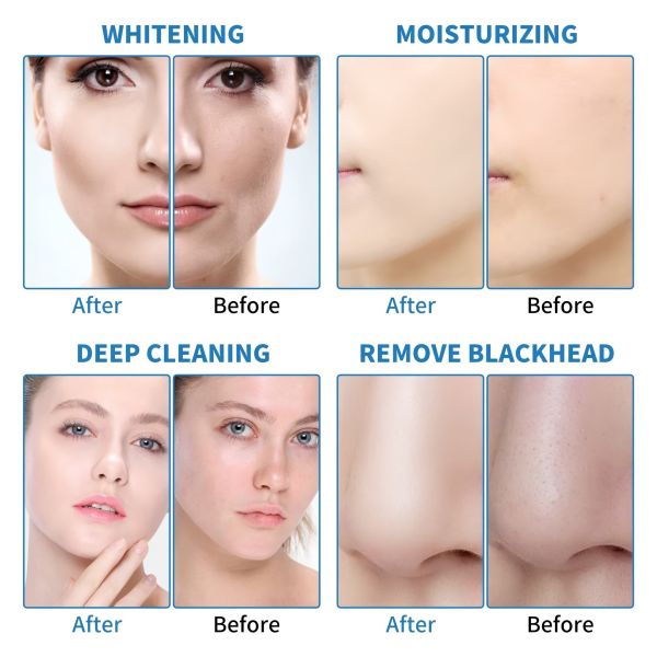6 In 1 Hydrafacial Machine , Hydro Oxygen Facial Machine OEM Support