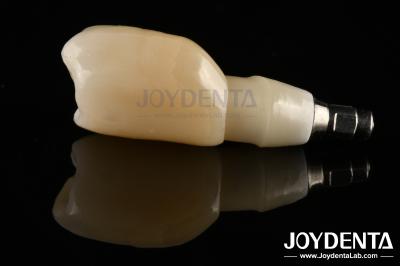 Shoulder Margin Design Dental Implant Bars For Wide Prosthetic Platform Needs