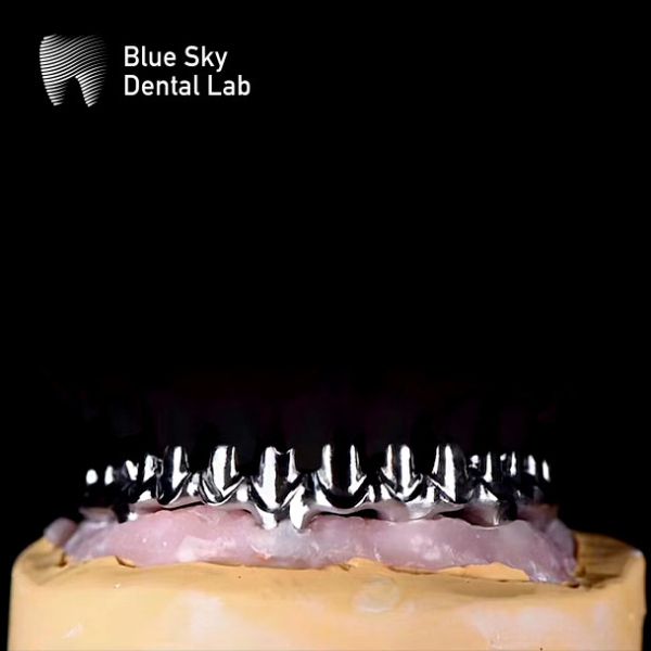 Puits à implants en titane pur à cadre métallique