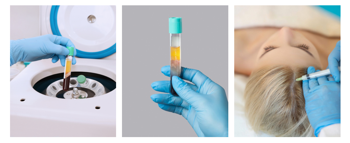 7ml Good Price Medical Blood Collection Tube Violet CBC Test Edta Tube Vacuum Blood Tube