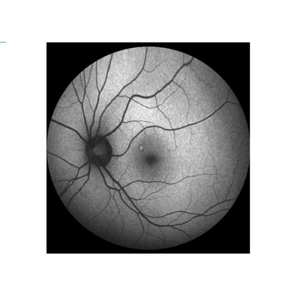 Equipo oftálmico de Angiograph Digital 160° de la retina