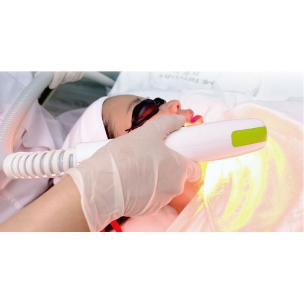 3000W 2 Handles DPL NIR Skin Rejuvenation Fast Hair Removal Machine