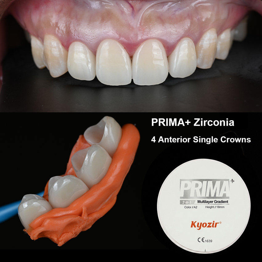 PRIMA+ Multilayer Zirconia Disc 3D PRO-ML CAD/CAM Dental Zirconia Blank