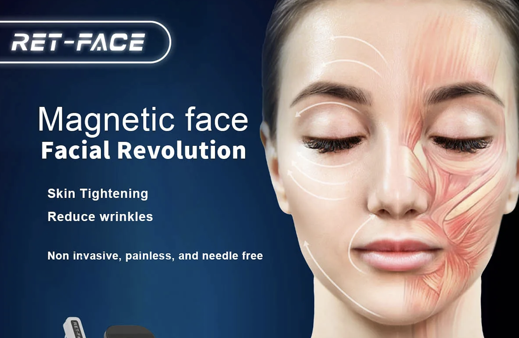 Skin Tightening Laser Beauty Machine Pe Face Vline Face Radio Frequency Electro Magnetic Therapy Machine