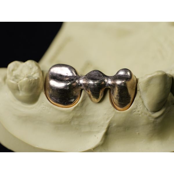 Audental 22 Au73.8% Cerámica Dental amarilla de aleación de aleaciones altas y nobles Odontología